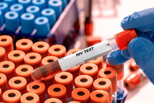 HIV v Česku dál přibývá. Případy nejsou jen ve velkých městech, týkají se i Plzeňského kraje