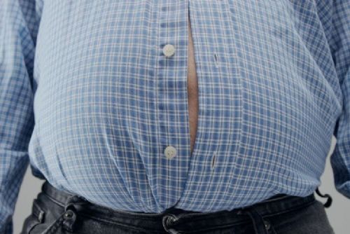 Děčínská nemocnice získala akreditaci pro bariatrickou chirurgii