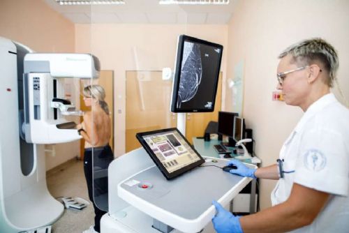 Klientky VZP budou moci od července na mamografii i bez žádanky