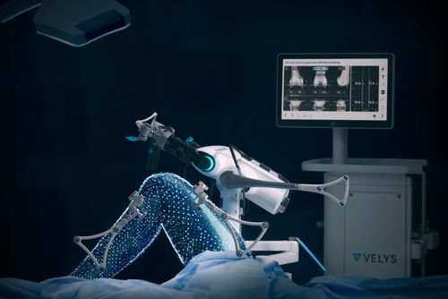 První robot v Česku mění kyčle v Mladé Boleslavi