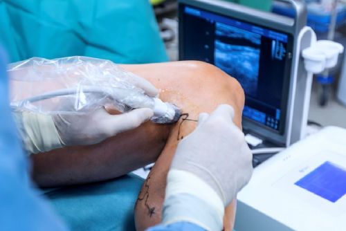 Nemocnice Písek rozšiřuje šetrné operace žil, hemoroidů i kýl: méně bolesti a rychlejší návrat domů